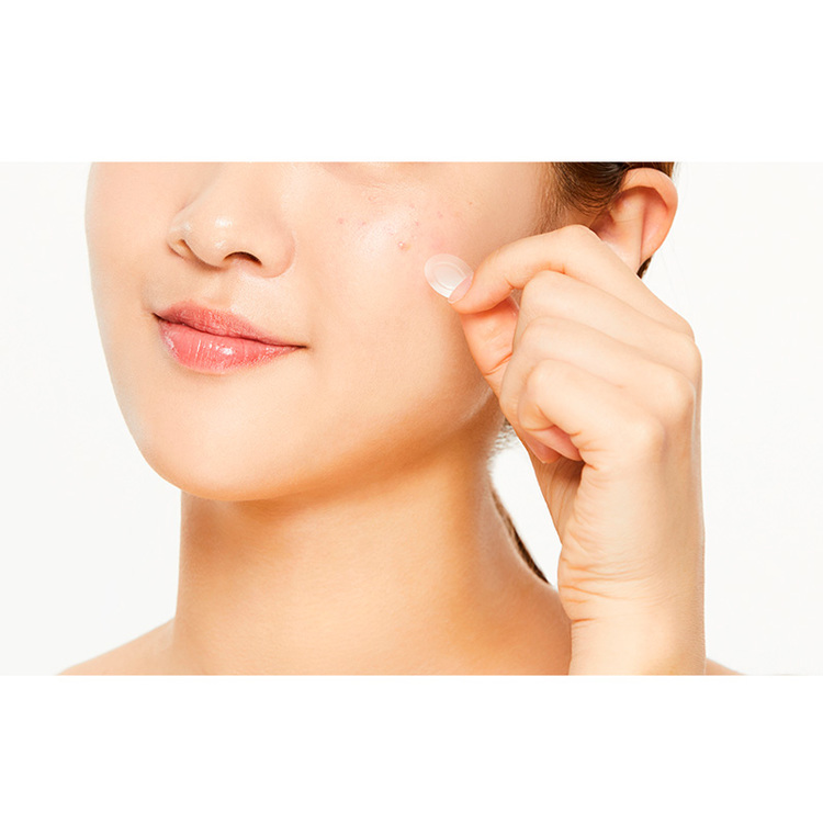 Acne patch | Acne treatments | Acne Solution | TimeBusinessnews