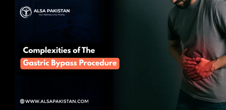 Gastric Bypass Procedure
