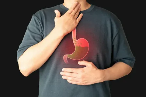 7 Essential Questions About Anti-Reflux Surgery