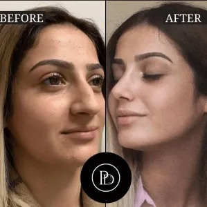 Unveiling My Stunning Glow at Dubai\’s Premier Aesthetic Clinic