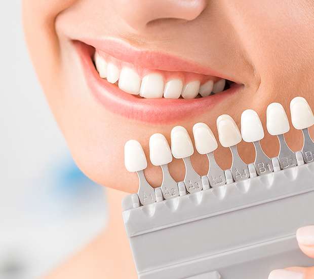 Cosmetic Dentistry in Boynton Beach
