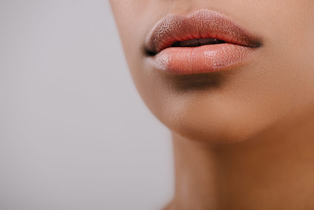 Juvederm Ultra XC