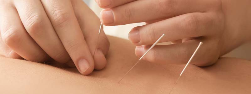 Do And Don'ts After Acupuncture?