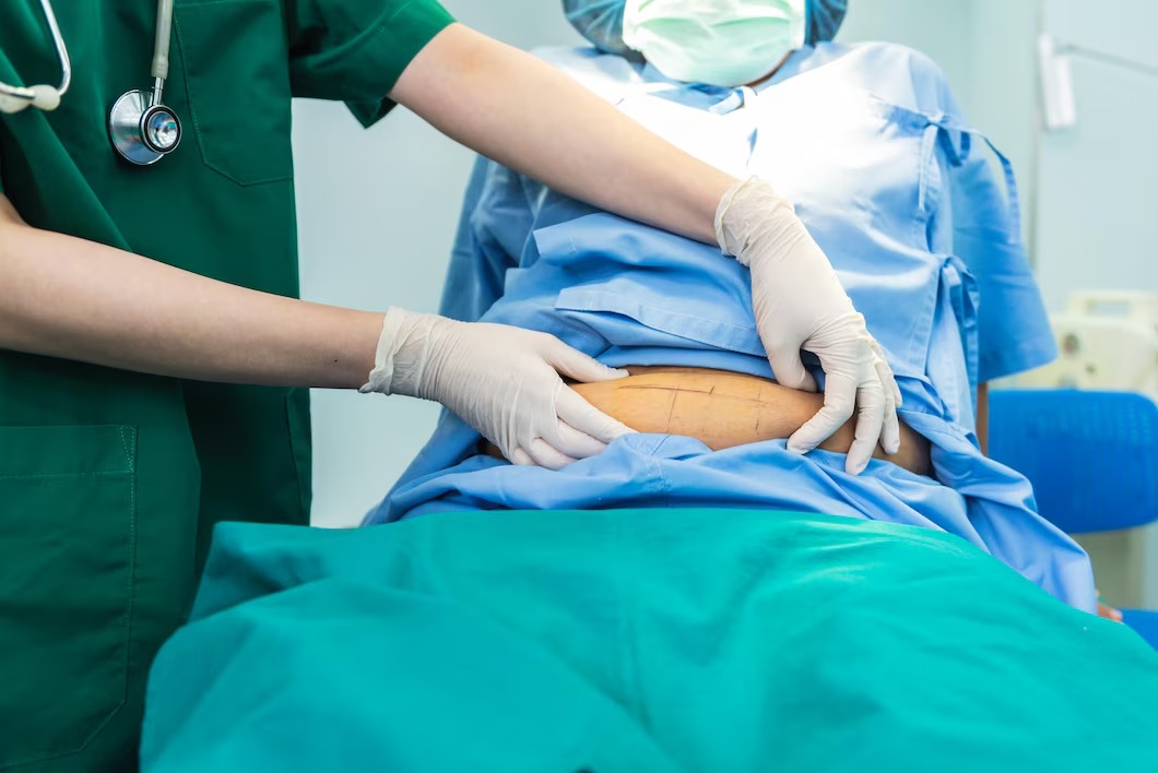 Unveiling the Post‑Surgery Journey: What Happens After a Gastric Sleeve. Unveiling the Post‑Surgery Journey: What Happens After a Gastric Sleeve.
