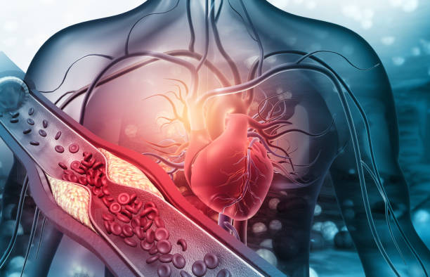 Heart and Cholesterol