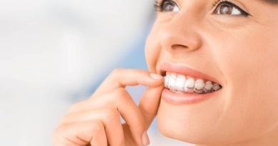 How Does It Work, And How To Get Affordable Invisalign