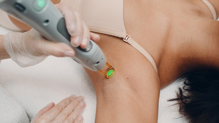 How Laser Hair Removal Affects Hair Growth Cycle