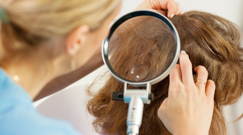 The best ways on ‘How to get rid of lice’