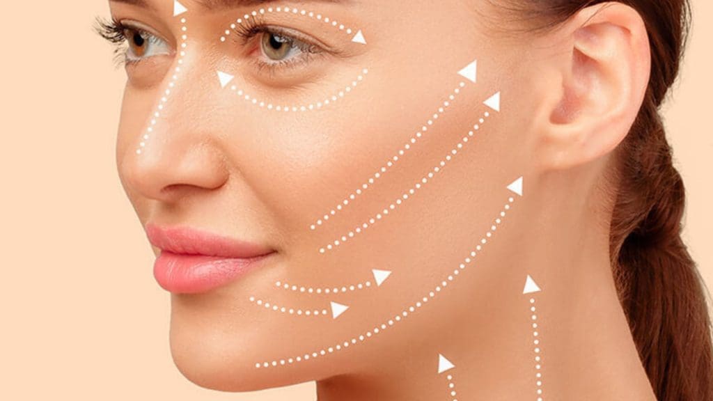 Thread lift technique illustrating facial lifting directions for sagging skin