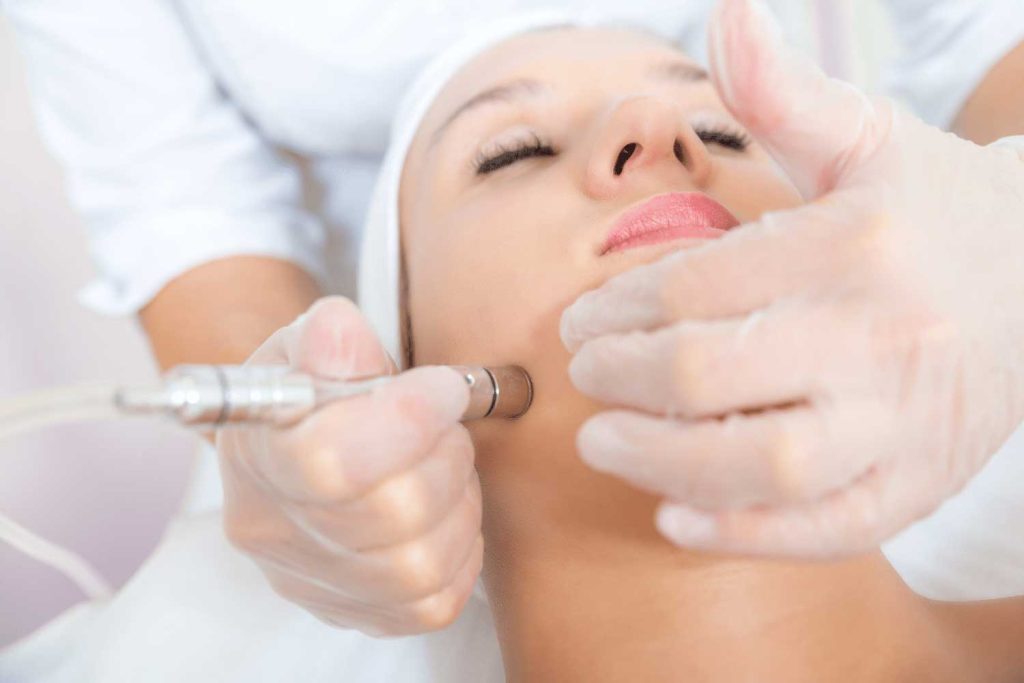micro-needling