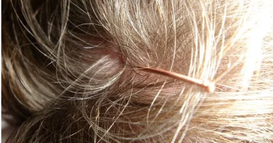 Cure Alopecia
