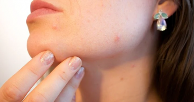 pimple treatment