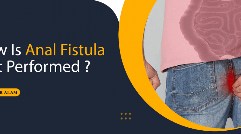 What is the Anal Fistula Test