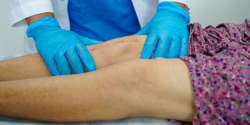 lymphatic and wound management