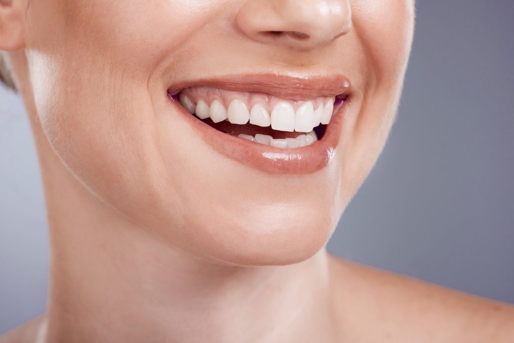 Teeth Whitening Fayetteville NC