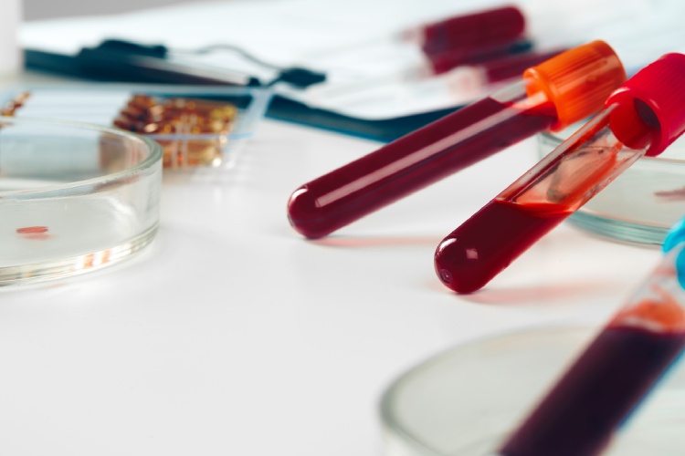 Lab Draw Services