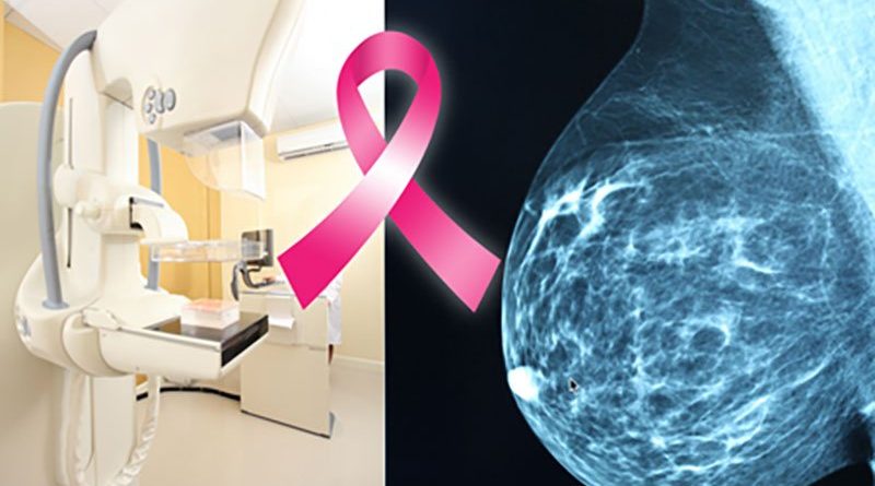 breast cancer screening in Alamogordo