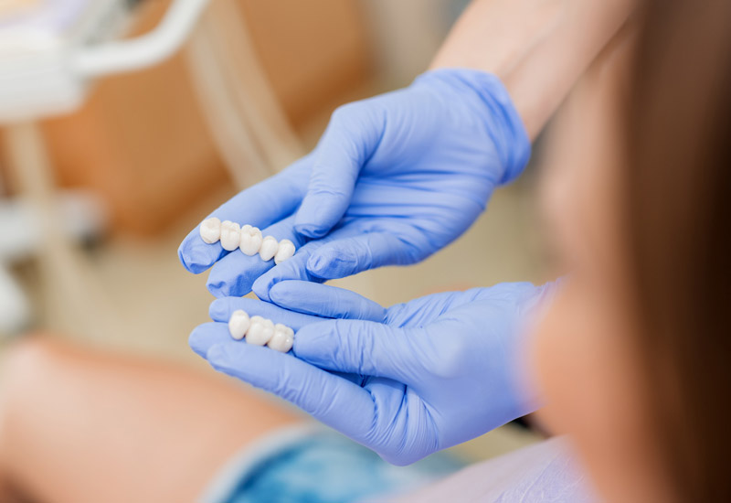 Same-Day Dental Crowns Near You in Edmonton | Are They Worth It?
