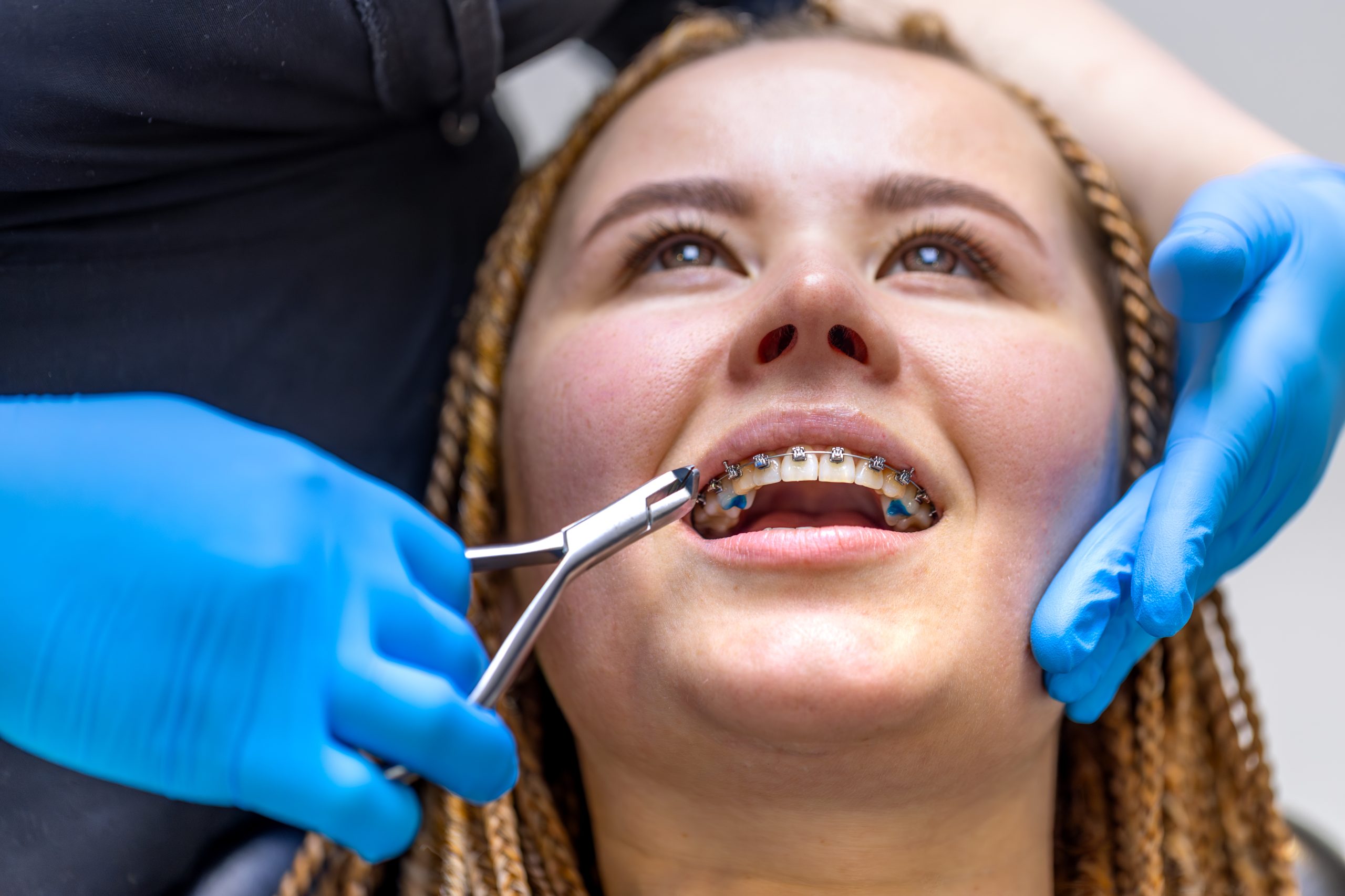 Factors You Must Know Before a Root Canal Procedure Factors You Must Know Before a Root Canal Procedure