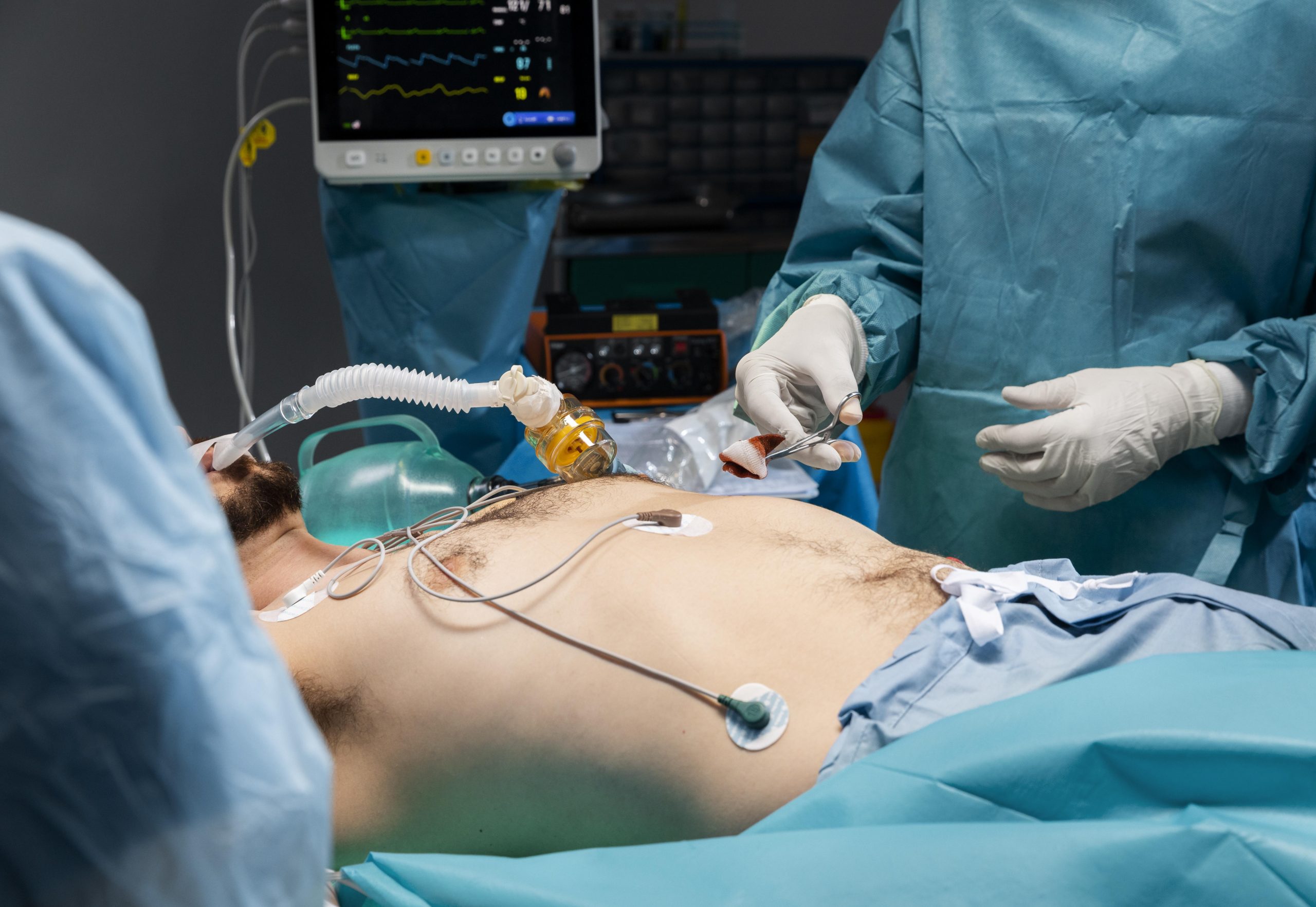 Step-by-Step Guide to Laparoscopic Acid Reflux Surgery