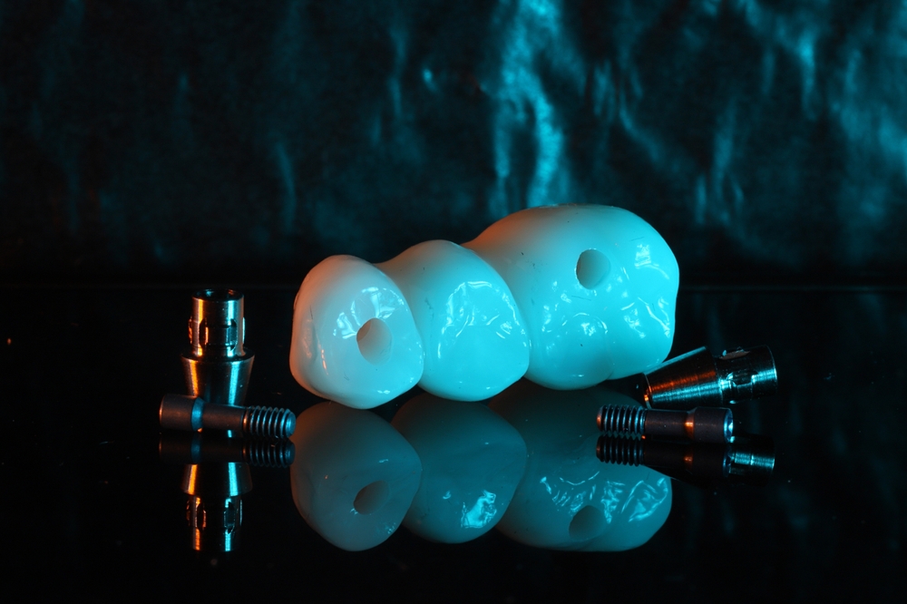 Do Dental Bridges Cause Problems? What You Should Know Do Dental Bridges Cause Problems? What You Should Know