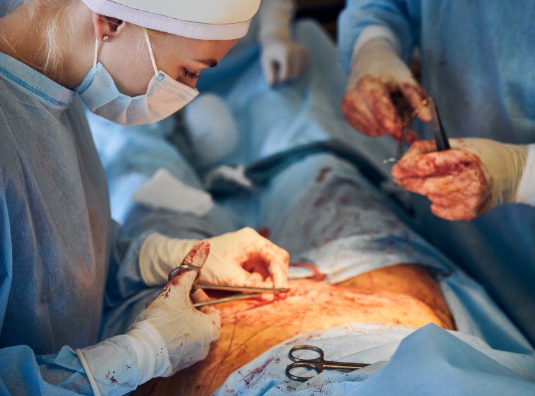 Laparoscopic Appendectomy