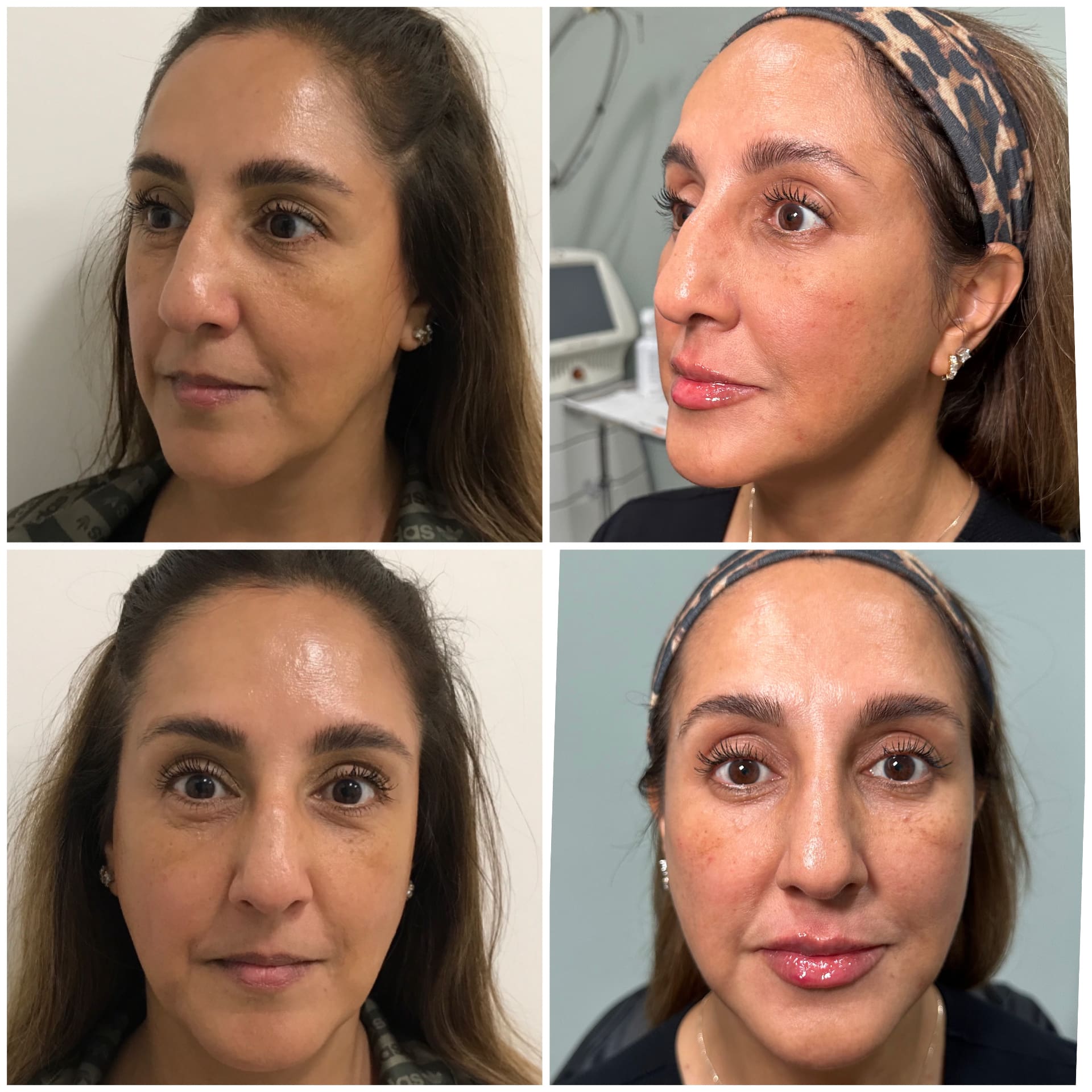 The Sanctuary Philosophy of Eternia Medspa