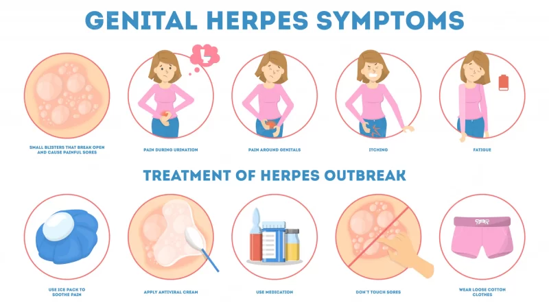 Genital Herpes Treatment