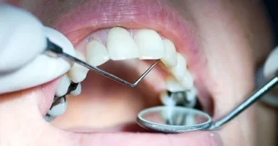 in Teeth