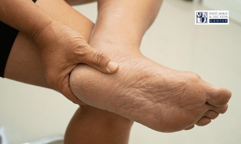 Heel Pain Treatment and the Relationship Between Tissue Stress and Pain