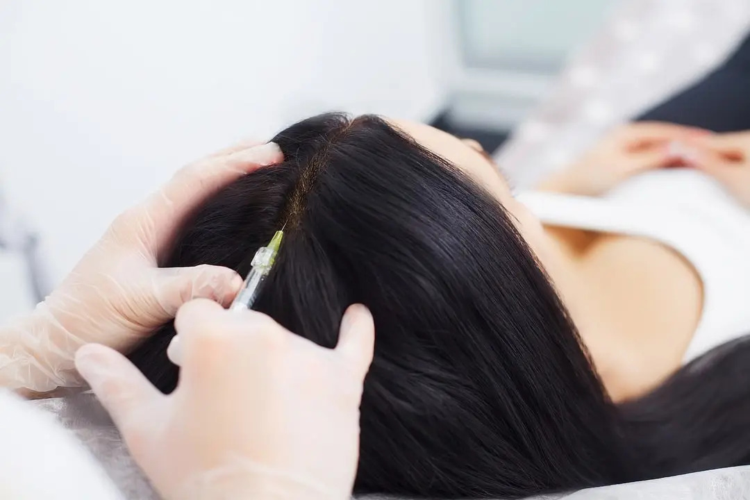 Innovations in Hair Transplantation: Exploring New Techniques and Future Trends – TIME BUSINESS NEWS