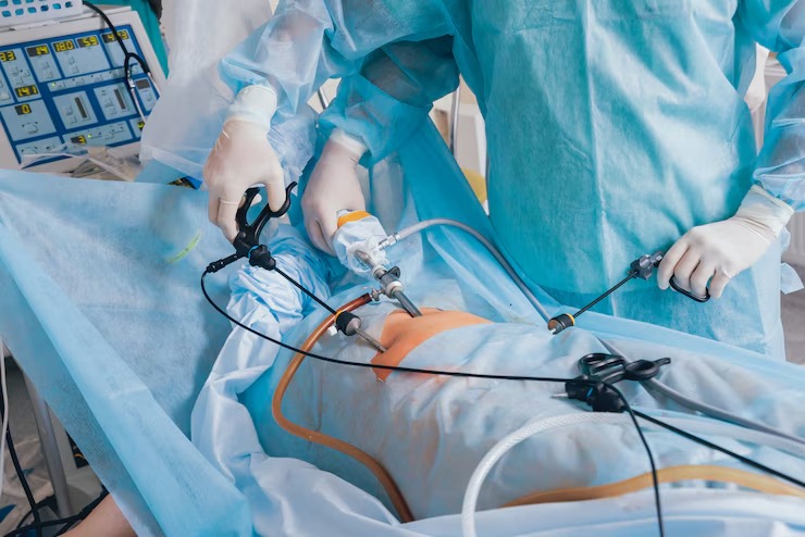 What to Expect from Laparoscopic Sleeve Gastrectomy in Pakistan