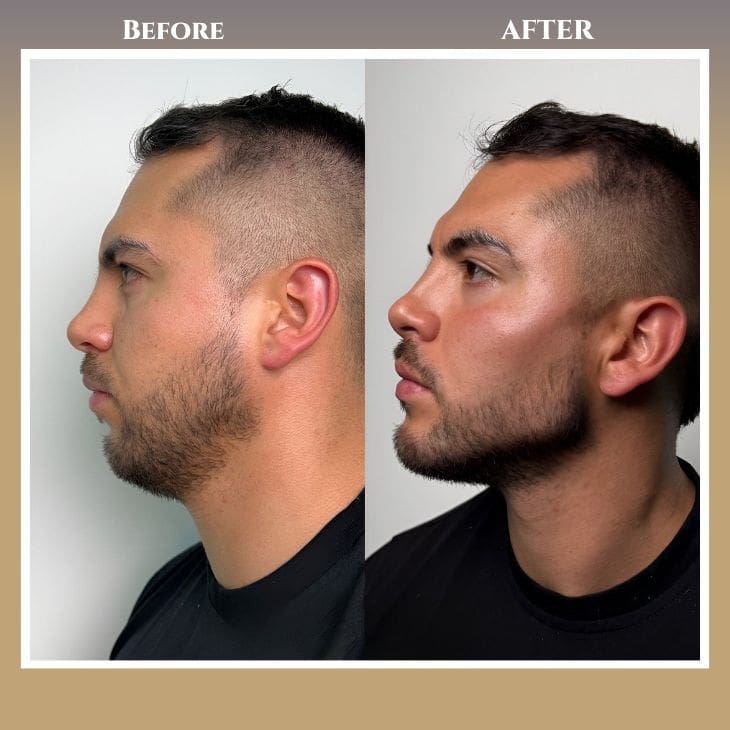 Jaw surgery in islamabad