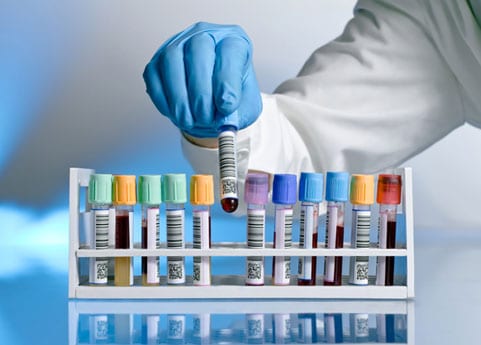 lab-testing-and-drug-screening