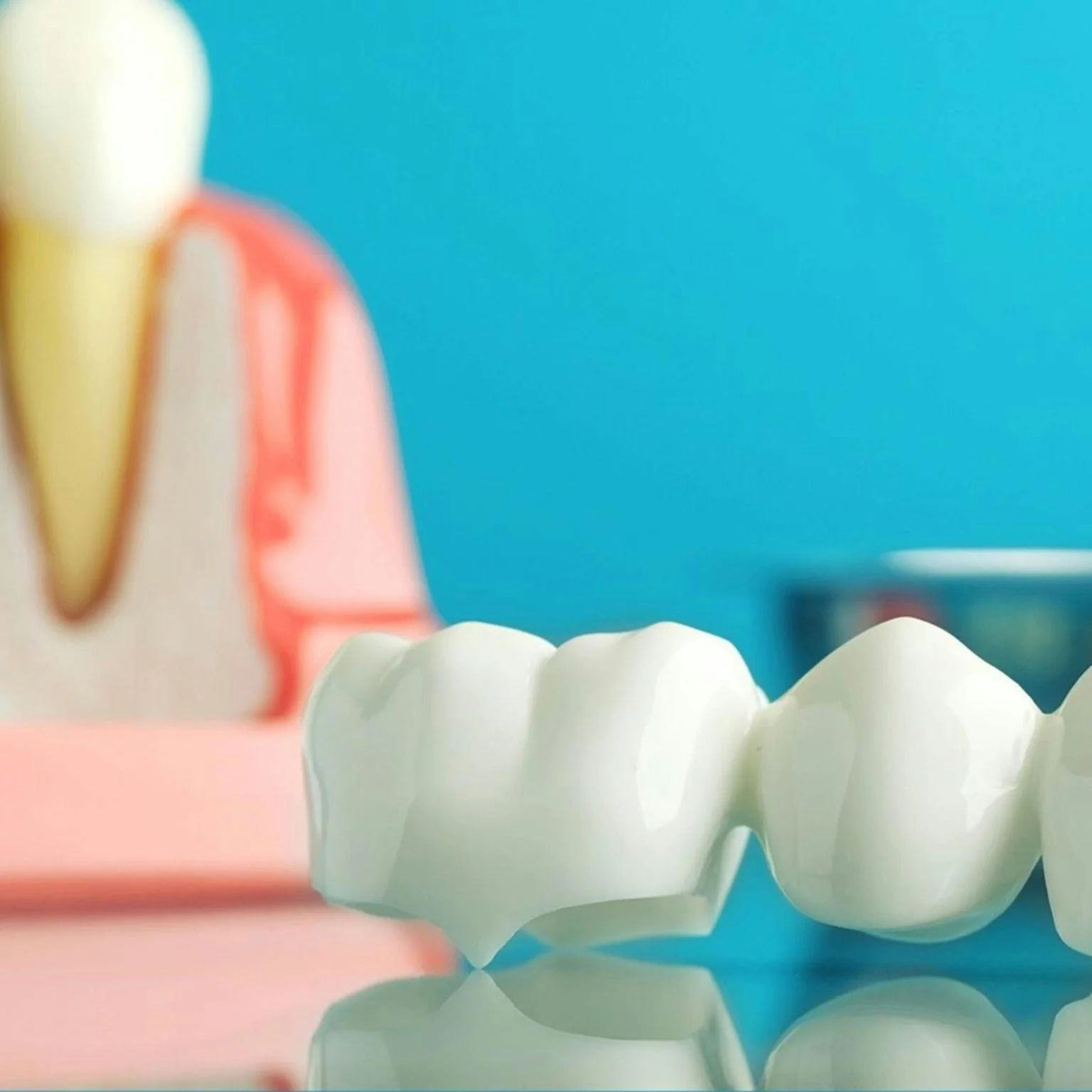Smiling Brighter with Veneer Teeth: The Ultimate Guide to Perfect Results﻿
