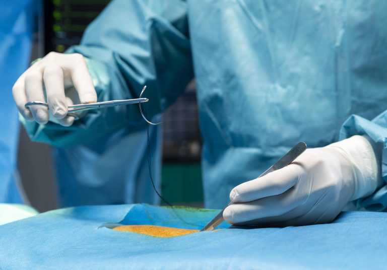 Roux‑Y Gastric Bypass in Pakistan