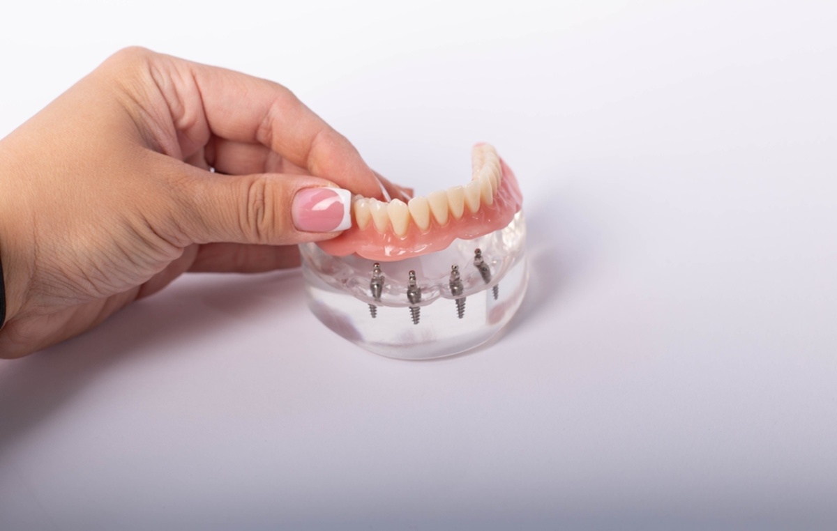 Discover the Essential Facts About Dentures with Nima Ebrahimi DDS