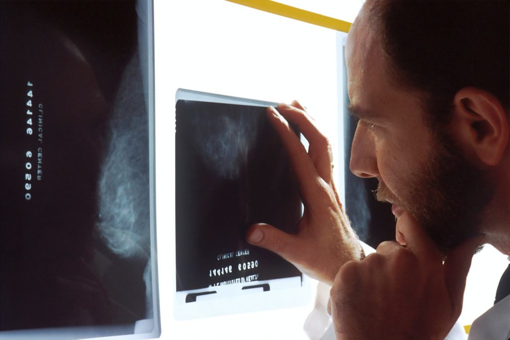 Description: x ray identifies issues with the vertebrae and joints that comprise the spine
